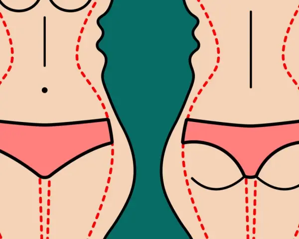Ilustracja pokazuje sylwetkę przed i po zabiegu liposukcji ud. Czerwone linie zaznaczają obszary do modelowania.