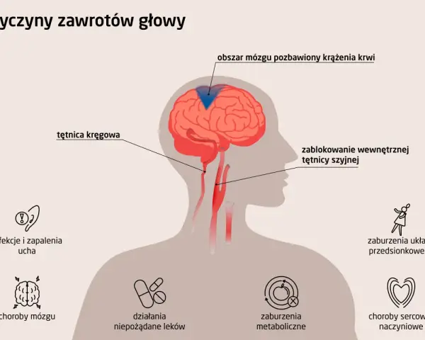 Przyczyny zawrotów głowy: blokada tętnicy szyjnej, problemy z mózgiem, uchem, metabolizmem, sercem lub leki.