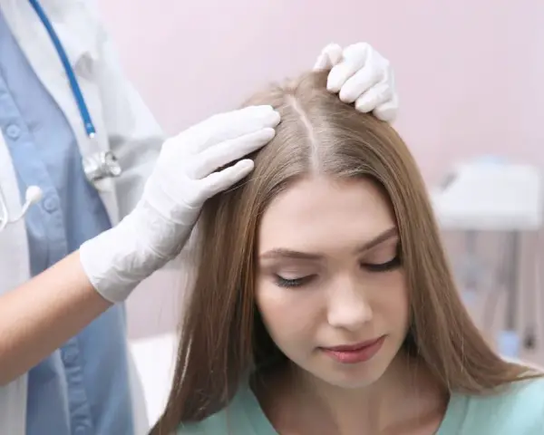 Lekarz w białej rękawiczce bada skórę głowy pacjentki, która martwi się nadmiernym wypadaniem włosów.