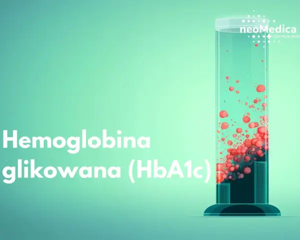 Hemoglobina glikowana (HbA1c) w probówce, symbolizująca kontrolę cukrzycy.