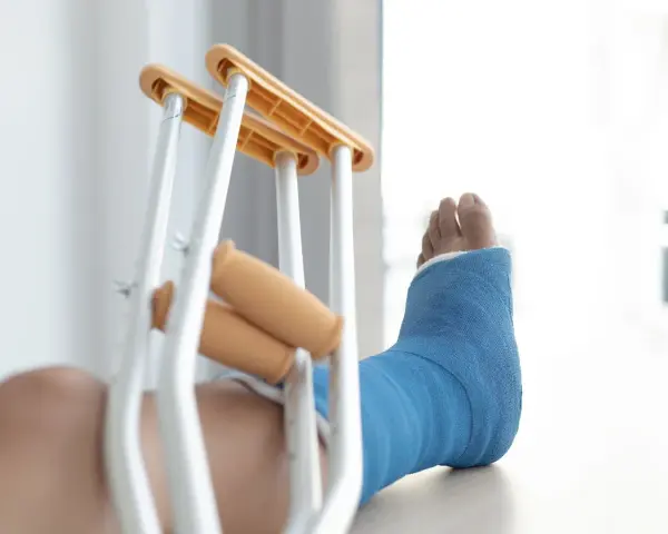 Noga w niebieskim gipsie, z kulami obok, sugeruje złamanie podudzia łącznie ze stawem skokowym.
