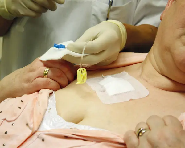 Eine Pflegekraft mit Handschuhen bereitet die Infusion an einem Port vene vor.