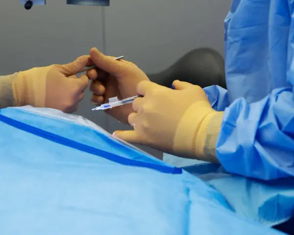 Mani guantate eseguono un intervento chirurgico oculare, forse un piombaggio retina, con precisione.