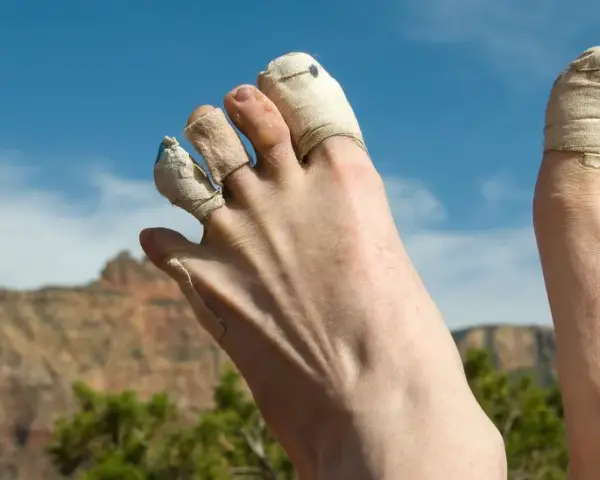 Zehen tapen wandern: Füße mit getapten Zehen ruhen nach einer langen Wanderung im Grand Canyon.
