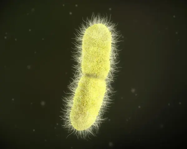 Żółta bakteria z licznymi rzęskami, przypominająca kształtem pałeczkę, to Klebsiella pneumoniae.