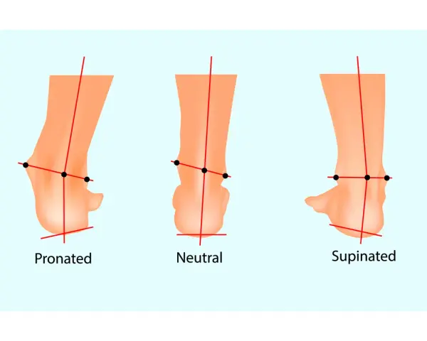 Illustrazione che mostra la pronazione e supinazione del piede: pronato, neutro e supinato, con linee rosse che indicano l'allineamento.