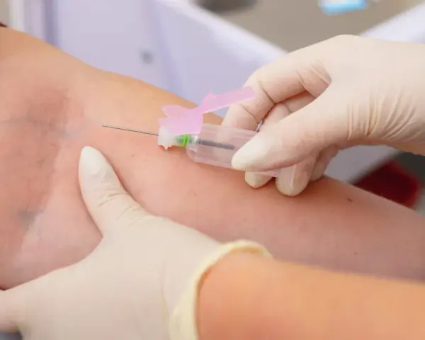 Pobieranie krwi do badań. Wyniki mogą wykazać, że limfocyty wysokie, co wymaga dalszej diagnostyki.