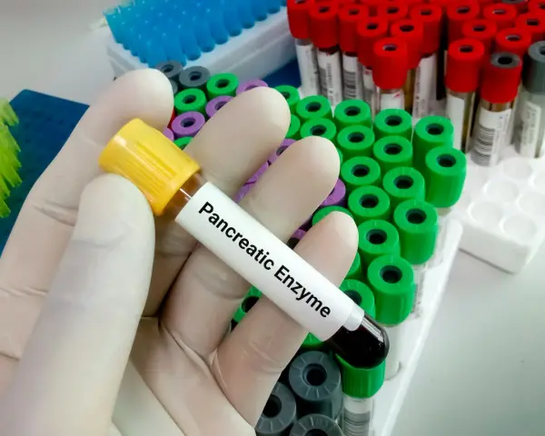 Ręka w rękawiczce trzyma probówkę z napisem "Pancreatic Enzyme", gotową do analizy. W tle widać wiele innych probówek.