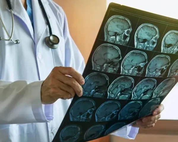 Jakie choroby psychiczne wykryje rezonans magnetyczny głowy i co to oznacza?