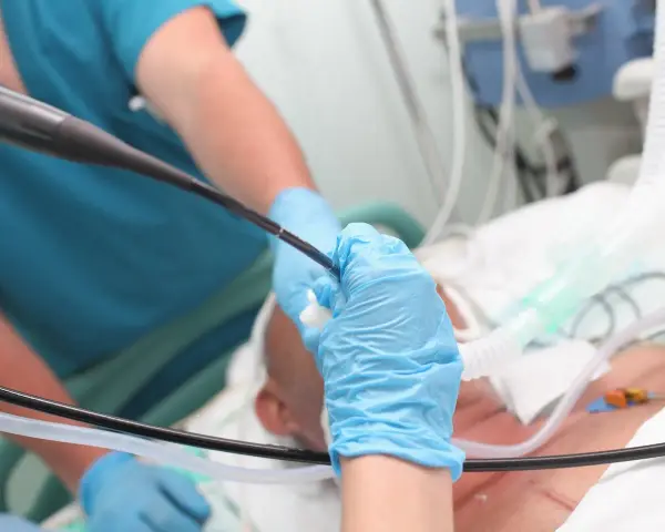 Lekarz w niebieskich rękawiczkach wykonuje bronchoskopię, wprowadzając endoskop do dróg oddechowych pacjenta podłączonego do aparatury medycznej.