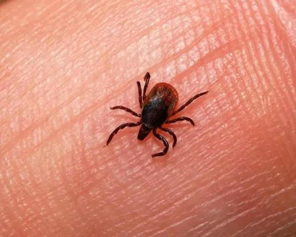 Una garrapata pequeña, con ocho patas, se arrastra sobre la piel humana.