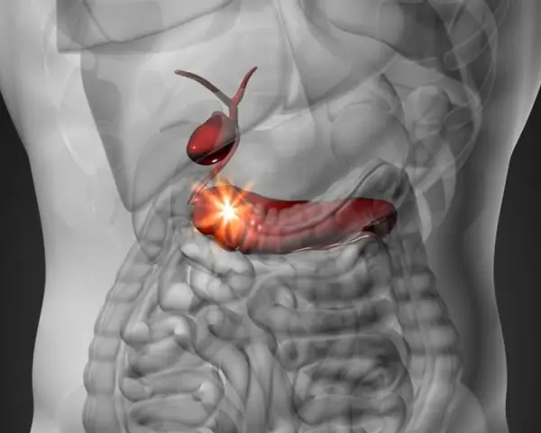 Anatomical illustration of a human torso showing a red gallbladder and pancreas with a bright light emanating from the pancreas.
