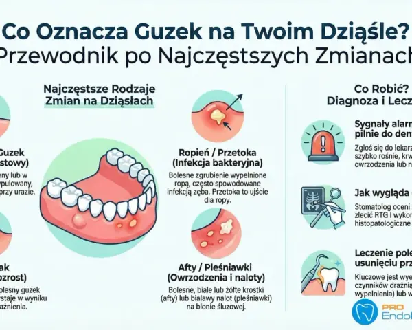 Ilustracja przedstawia różne zmiany na dziąśle, w tym nadziąślaka, ropień i włókniak. Opisuje, jak rozpoznać i leczyć guzek w jamie ustnej.