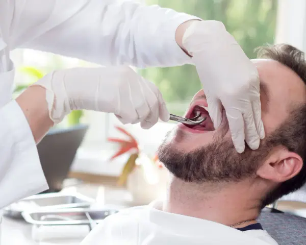 Dentysta w rękawiczkach używa kleszczy do usuwania zęba pacjentowi.