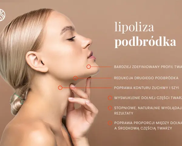 Kobieta po zabiegu lipolizy podbródka. Widoczna poprawa konturu żuchwy, redukcja drugiego podbródka i smuklejsza dolna część twarzy.