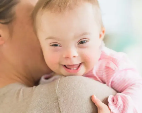 Ein lächelndes, leichtes Down-Syndrom Baby wird von seiner Mutter gehalten.