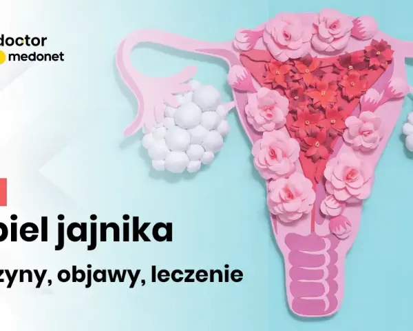 Jakie leki hormonalne na torbiel jajnika mogą skutecznie pomóc?