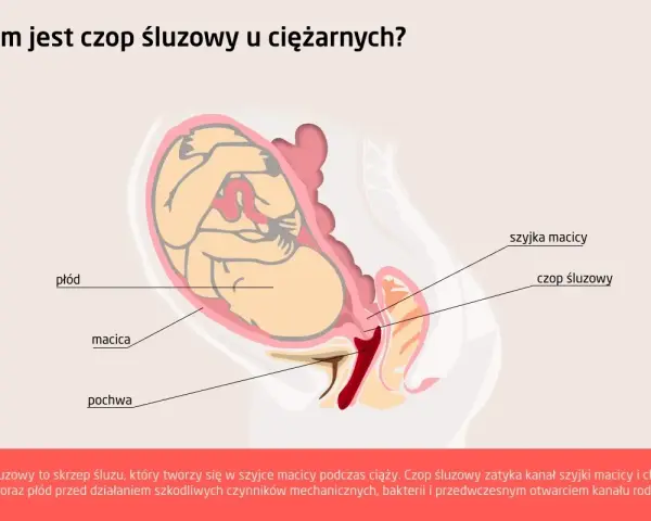 Ilustracja przedstawia płód w macicy, z zaznaczonym czopem śluzowym w szyjce macicy. Chroni on macicę i płód.