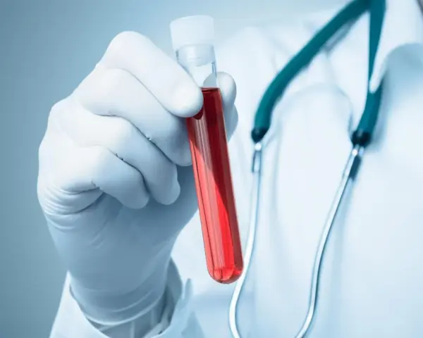 Rękawiczka z pipetą trzyma probówkę z czerwoną cieczą. Lekarz w białym kitlu i zielonym stetoskopie. Co to aptt?