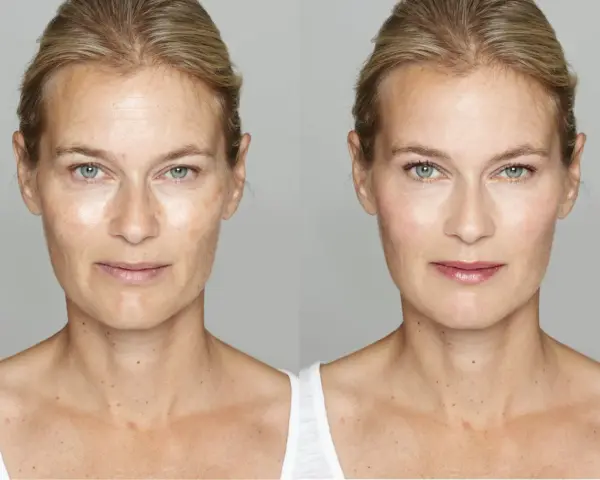 Before and after of a woman's face. The left side shows signs you are aging poorly: wrinkles, sun spots, and uneven skin tone. The right side shows a smoother, brighter complexion.