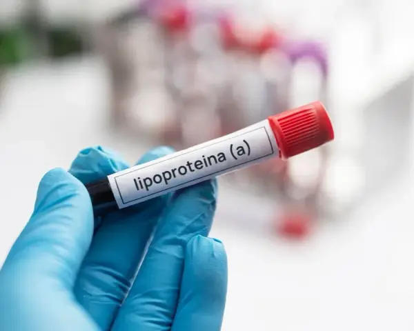 Ręka w niebieskiej rękawiczce trzyma probówkę z etykietą "lipoproteina (a)". Badanie poziomu tej lipoproteiny jest ważne.