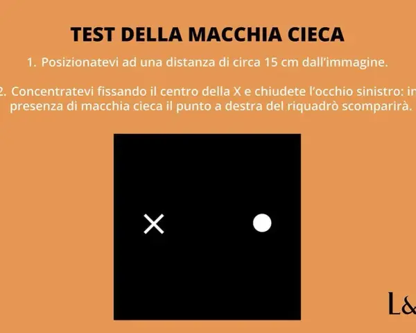 Test della macchia cieca: fissa la X, chiudi l'occhio sinistro. Il punto a destra del riquadro nero potrebbe scomparire, come se fosse vedere ombrato da un occhio.