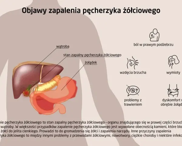 Anatomia człowieka z zaznaczonym pęcherzykiem żółciowym i objawami jego zapalenia: ból, wzdęcia, wymioty, problemy z trawieniem.