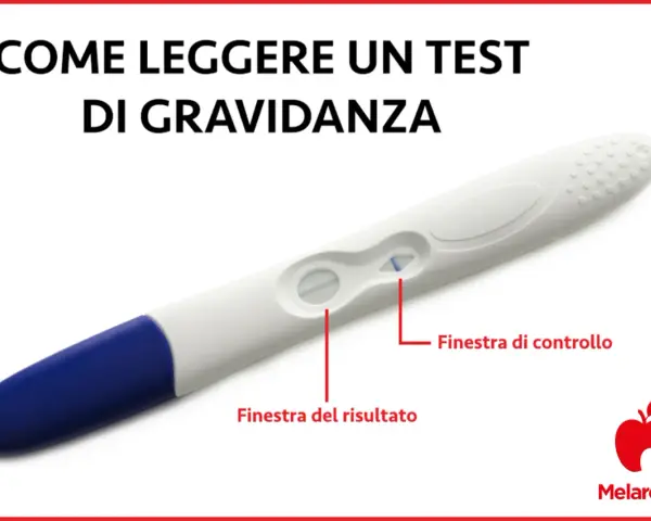 Test di gravidanza positivo con due linee visibili. Indicazioni su come leggere il risultato.