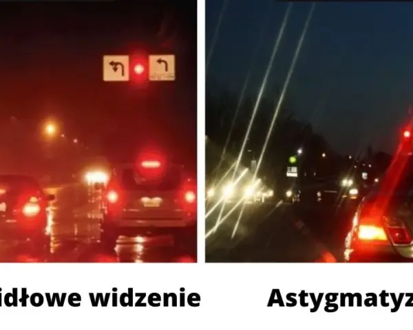 Astygmatyzm: Jak widzi świat astygmatyk? Zrozum niezborność oka