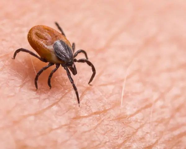 Makro zbliżenie na kleszcza wbitego w skórę. Pajęczak z ośmioma odnóżami zaczyna swoją niebezpieczną ucztę.
