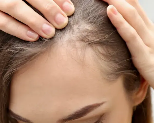 Dłonie kobiety dotykają jej czoła, sprawdzając delikatne baby hair przy linii włosów.