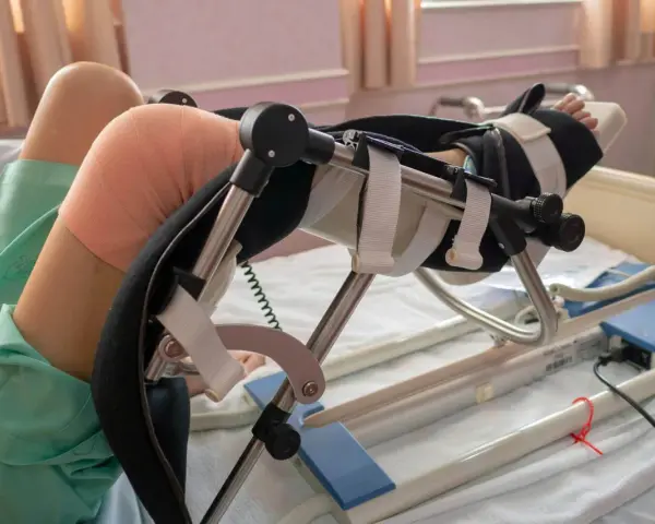 Rehabilitacja po endoprotezie kolana: Ile trwa i co Cię czeka?
