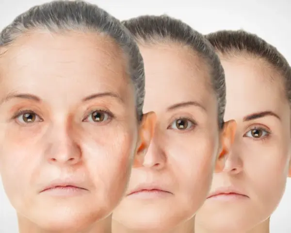 Trois visages de femmes montrant le processus de régénération de la peau, du plus âgé au plus jeune.