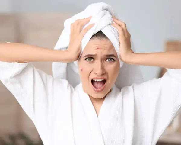 Verzweifelte Frau mit Pickeln im Gesicht, die ihre Hände an den Kopf legt. Sie leidet unter oxidativem Stress der Haut.