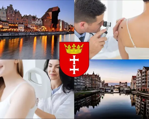 Gdański krajobraz, dermatolodzy badający znamiona, herb miasta.