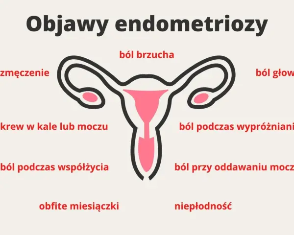 Objawy endometriozy: ból brzucha, zmęczenie, krew w kale/moczu, ból podczas współżycia, obfite miesiączki, ból głowy, ból podczas wypróżniania, ból przy oddawaniu moczu, niepłodność.