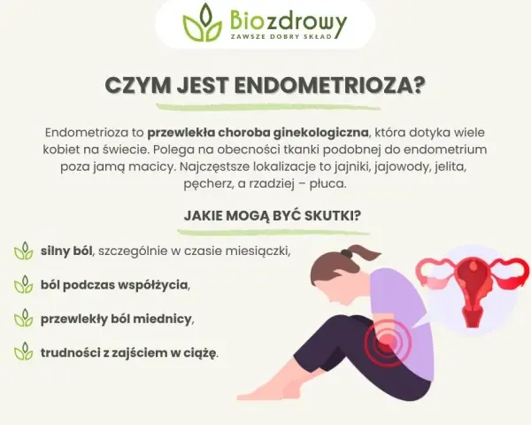 Endometrioza objawy forum: co naprawdę musisz wiedzieć o bólu