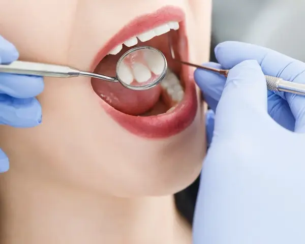 Ile kosztuje wizyta u dentysty bez ubezpieczenia? Sprawdź ceny!