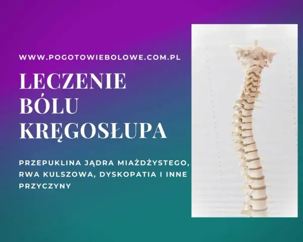 Model kręgosłupa, leczenie bólu kręgosłupa, przepuklina jądra miażdżystego, rwa kulszowa, dyskopatia.