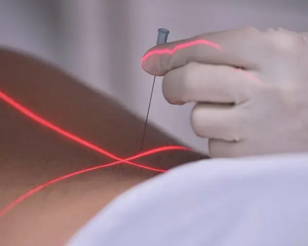 Eine Hand in einem Handschuh führt eine prt spritze unter rotem Laserlicht.