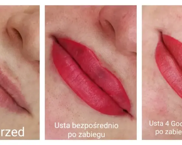 Porównanie ust przed makijażem permanentnym, bezpośrednio po zabiegu i 4 godziny później. Pokazuje, jak długo goją się usta po makijażu permanentnym.