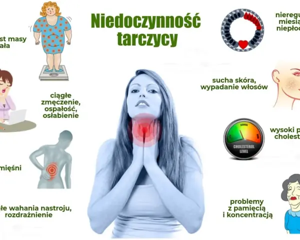 Niedoczynność tarczycy: objawy psychiczne to wahania nastroju, rozdrażnienie, problemy z pamięcią i koncentracją, zmęczenie.