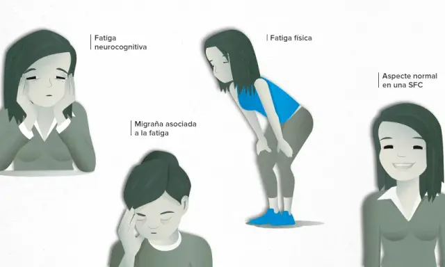 Síntomas de fatiga crónica: ¿Es más que cansancio normal?