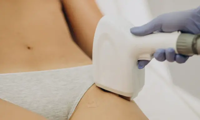 Depilacja laserowa bikini: Czy wiesz, jak to działa? Pełny przewodnik