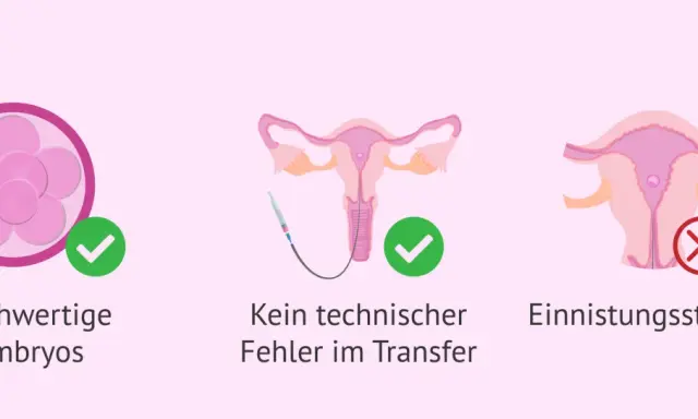 Hochwertige Embryos und kein technischer Fehler im Transfer sind wichtig. Eine Einistungsstörung kann das verhindern.