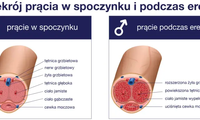 Przekrój prącia ukazuje jego budowę w spoczynku i podczas erekcji, z zaznaczonymi naczyniami krwionośnymi i cewką moczową.
