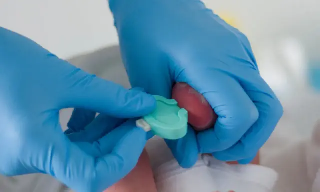 Mani con guanti blu eseguono il test di Guthrie su un neonato, raccogliendo una goccia di sangue dal tallone.