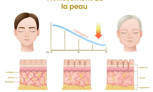 Le vieillissement cutané montre une baisse du collagène, entraînant rides et perte d'élasticité. Quels sont les effets indésirables du collagène ? L'image illustre la dégradation.