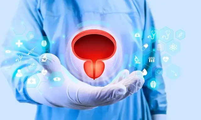 Dłoń w rękawiczce medycznej prezentuje pęcherz moczowy, symbolizując diagnostykę i rokowania w przypadku raka prostaty C61.