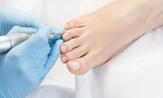 Un podologue réalise une pédicure avec un appareil rotatif sur les ongles d'un pied.